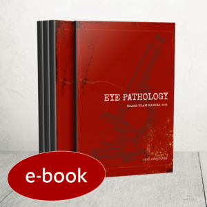 Eye Pathology: Resident Manual (e-book)
